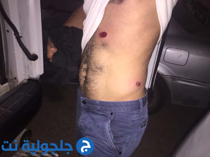 محاولة اعتقال شاب واصابة ثلاثة مواطنين اصابات متوسطة في كفر قاسم